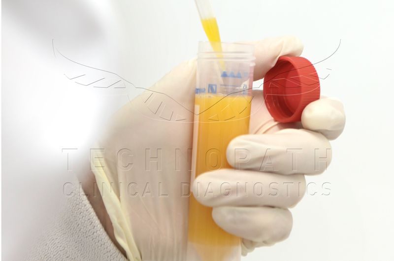 A Technopath laboratory technologist pipettes IVD Raw Material,Triglyceride Extract.